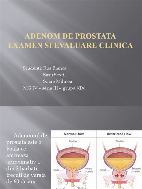 adenom de tratare a prostatei pdf